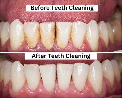 Womens Dental Care